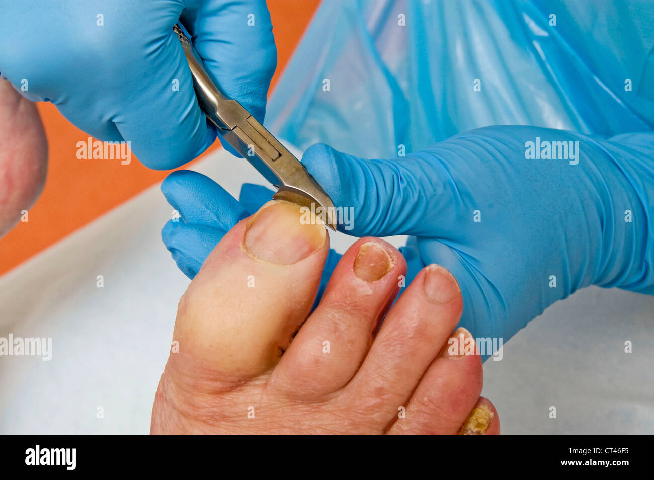 Nail wounds hires stock photography and images Alamy