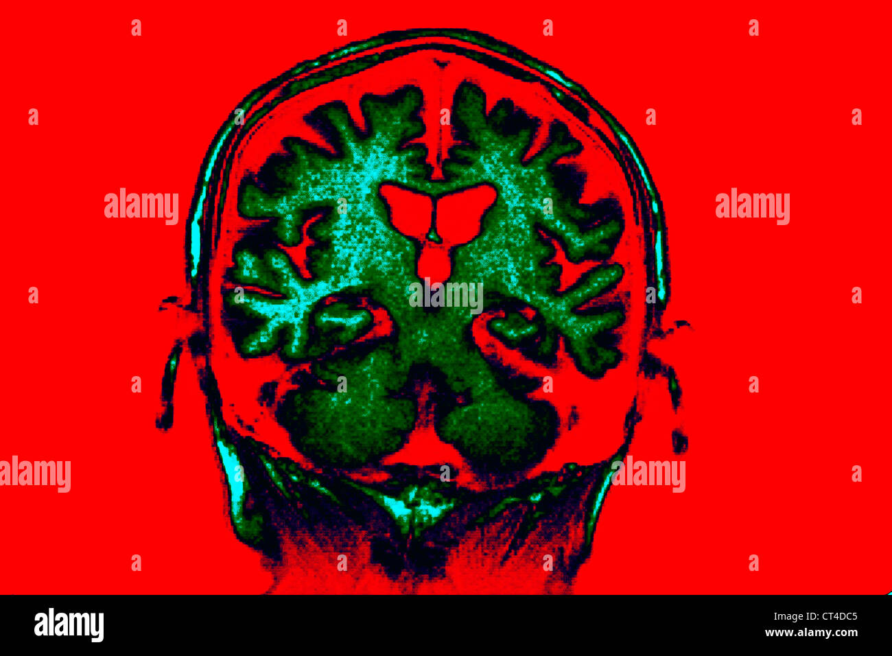 Human brain memory mri hires stock photography and images Alamy