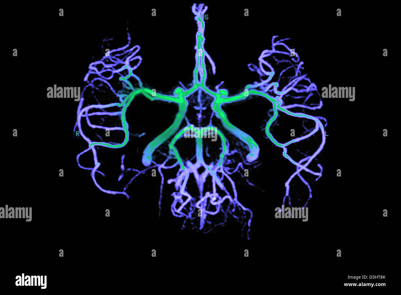 Circle of willis hires stock photography and images Alamy
