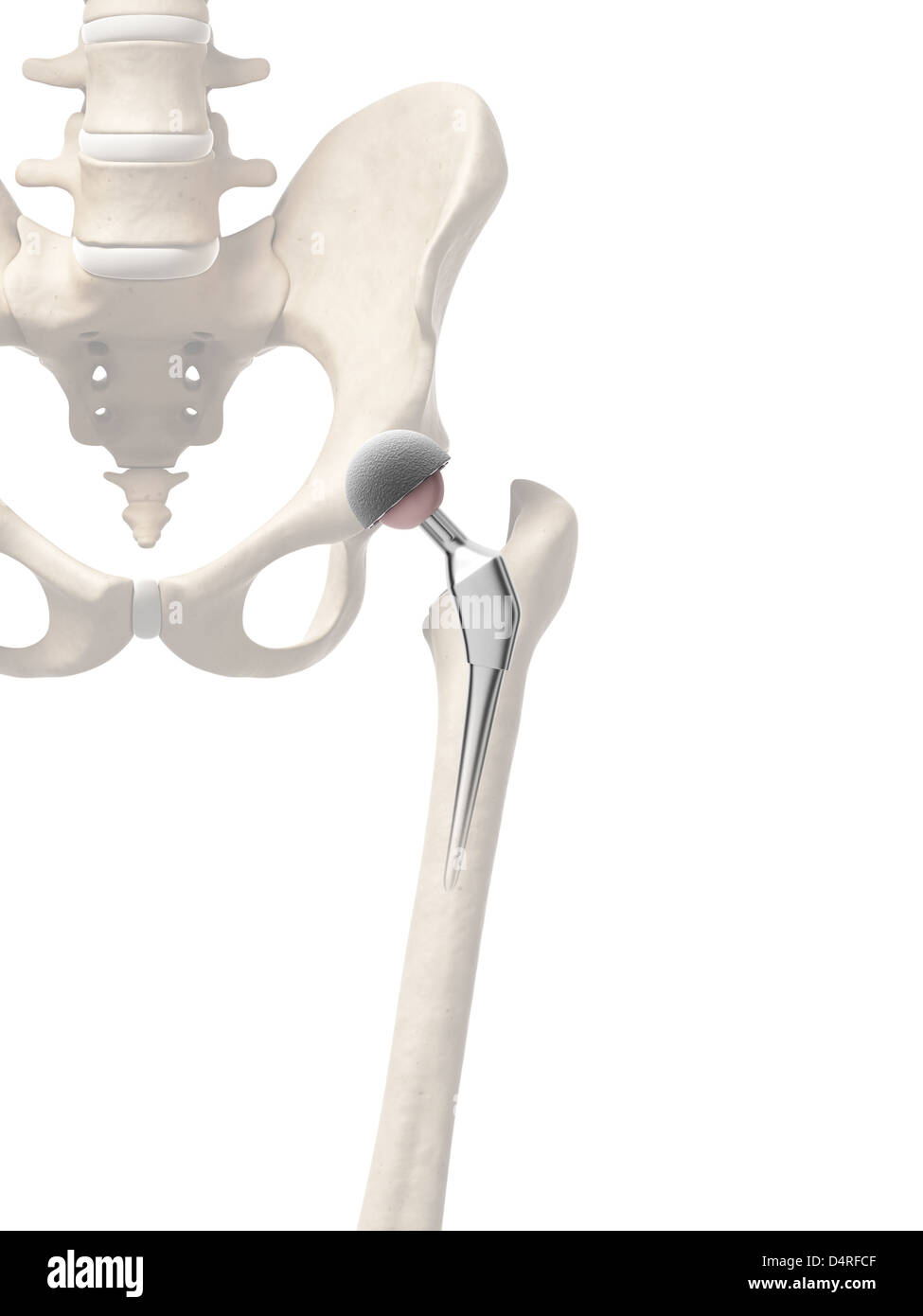 Human hip joint femur Cut Out Stock Images & Pictures - Alamy