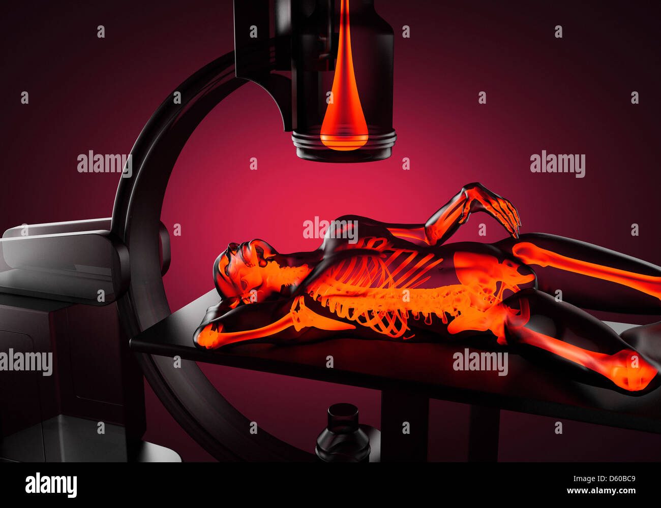 xray examination Stock Photo Alamy