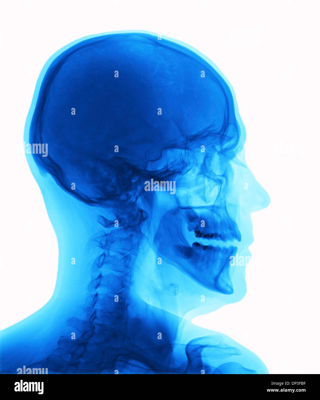 Human head, xray Stock Photo Alamy