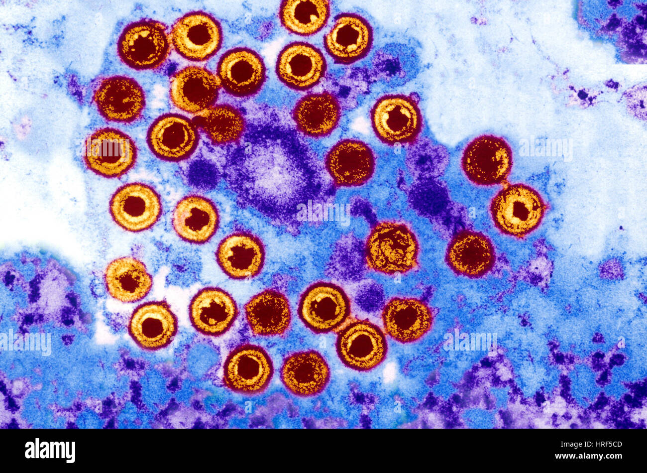 Herpes vesicles hires stock photography and images Alamy