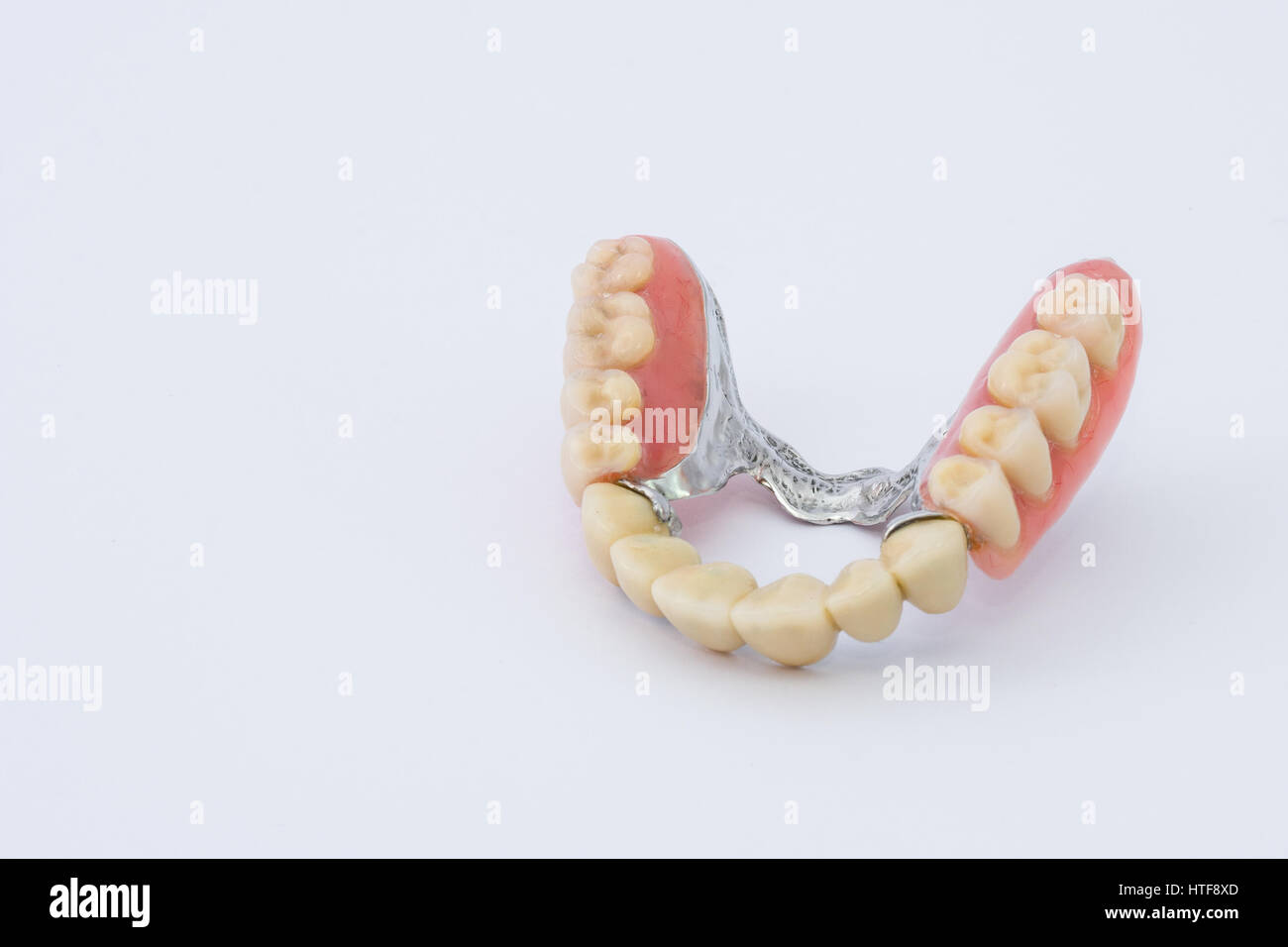 Removable dental prosthesis hires stock photography and images Alamy