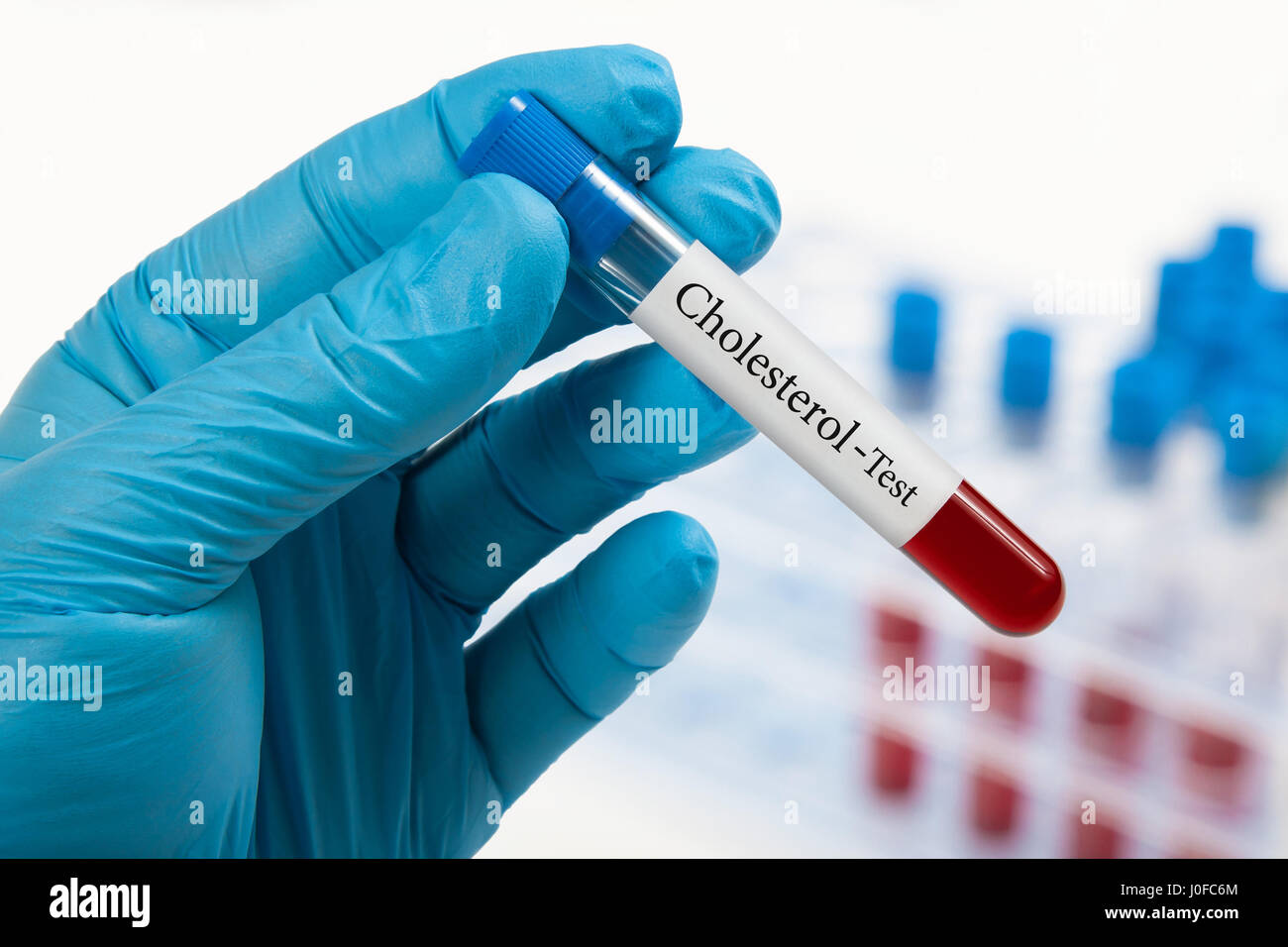 Blood sample label hires stock photography and images Alamy