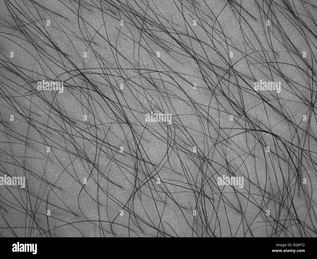 Haarwurzel Black and White Stock Photos & Images Alamy