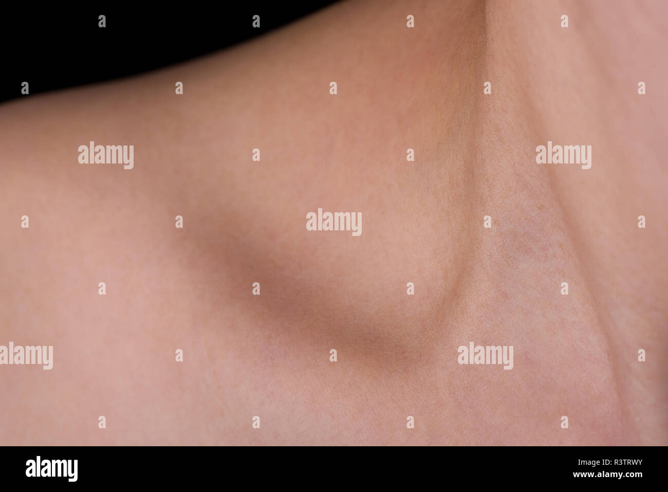 Collarbone hires stock photography and images Alamy