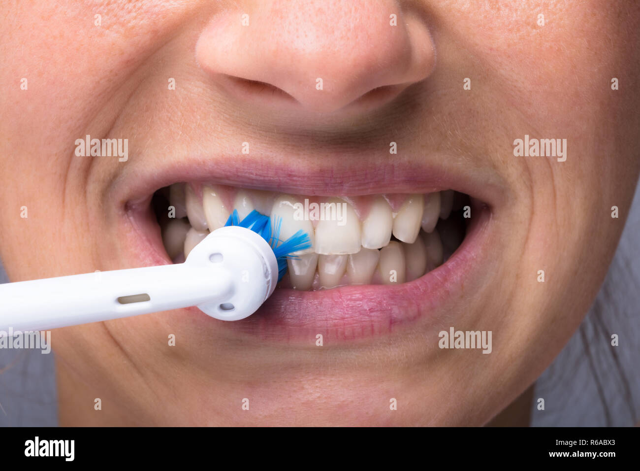 Woman's Teeth With Electrical Toothbrush Stock Photo Alamy