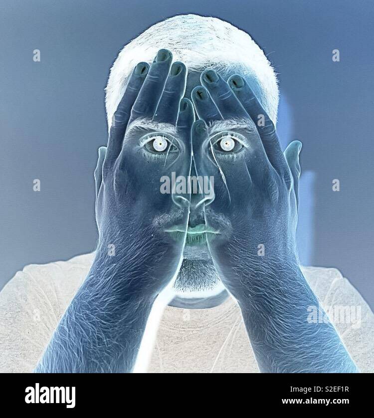 Finger x ray color thumb colour hires stock photography and images Alamy