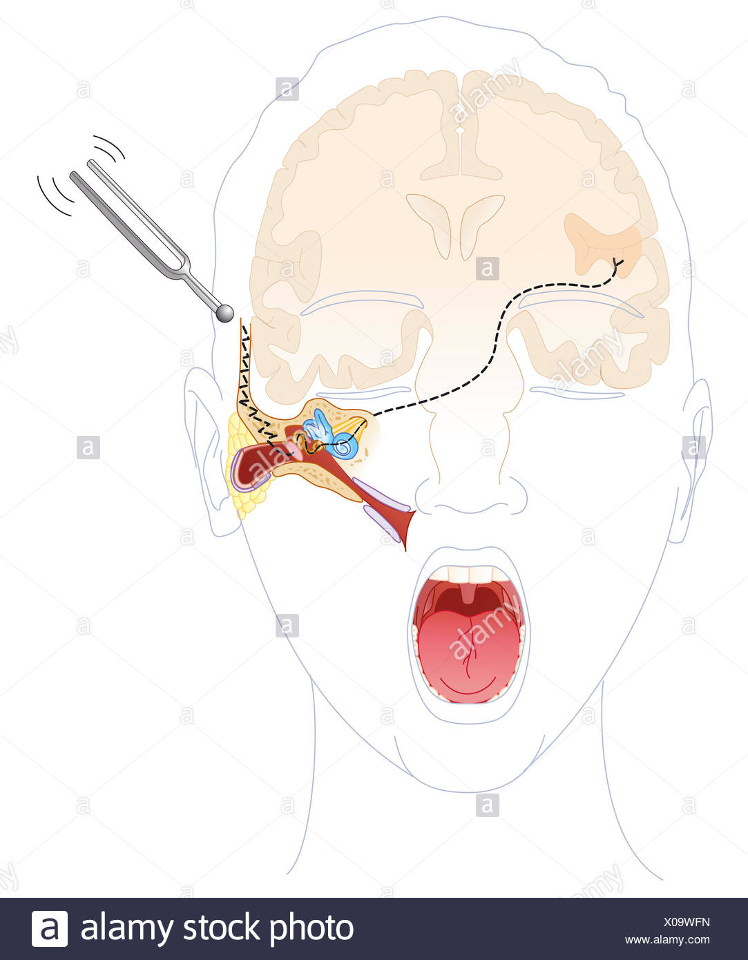 Auditory Cortex High Resolution Stock Photography and Images Alamy