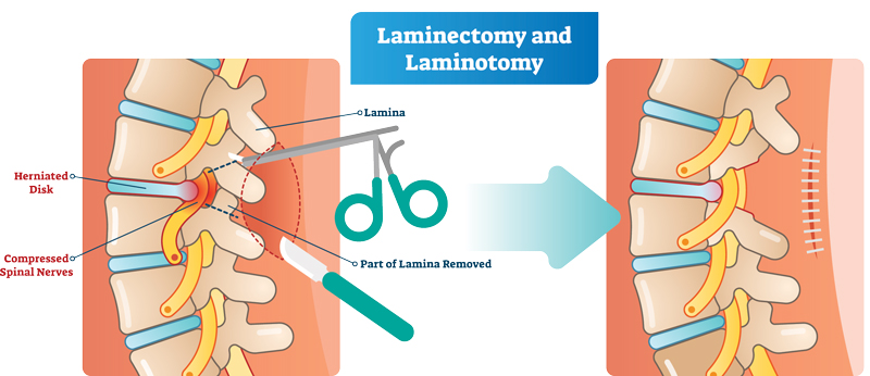 New Cpt Codes For 2023 Master Cpt® 2022 Coding With This Expert Overview - Aapc Knowledge Center