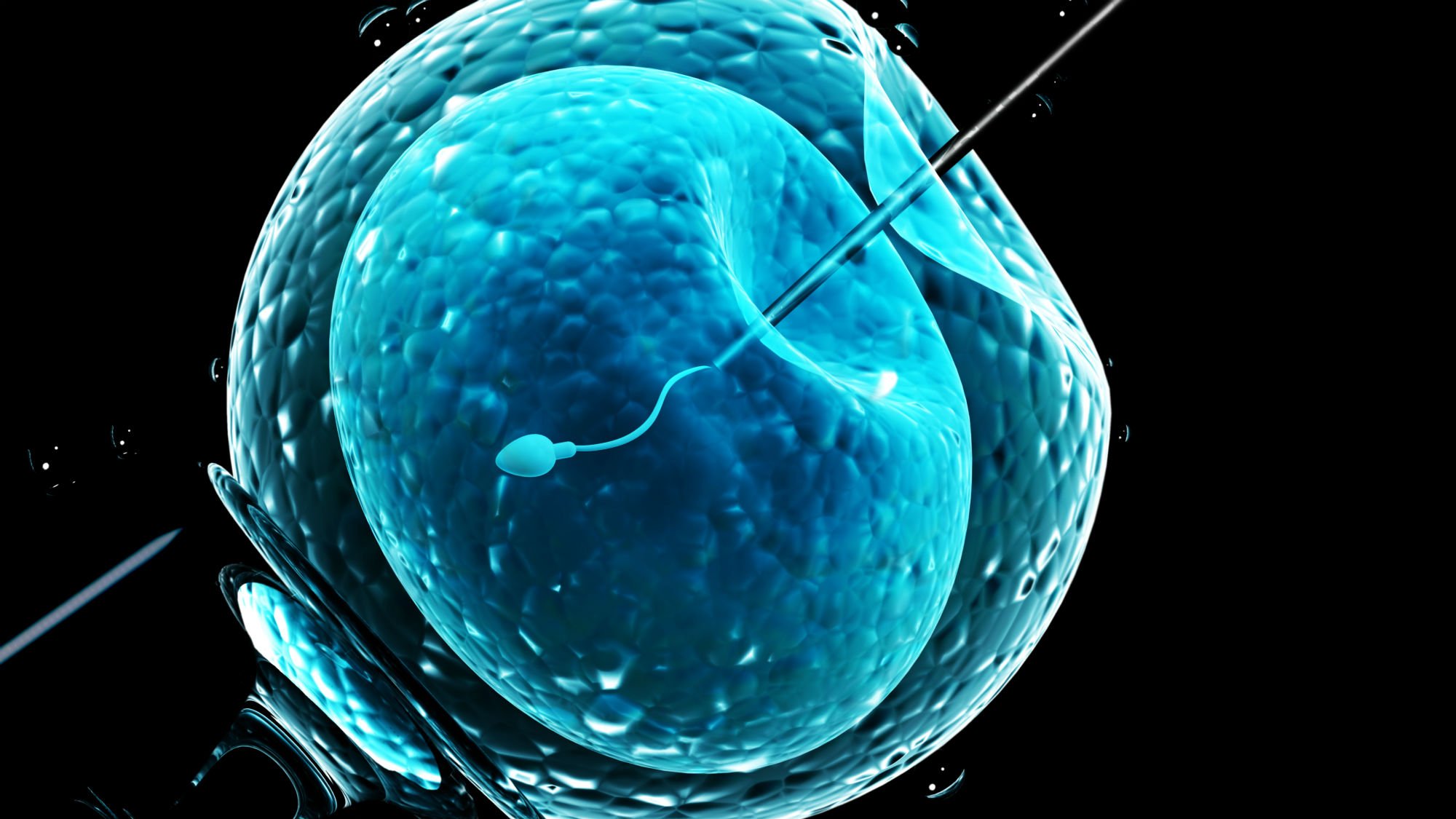 FIV qu'estce que la fécondation in vitro