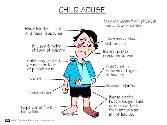 Recognize the Signs of Physical Abuse Mercer County Children's