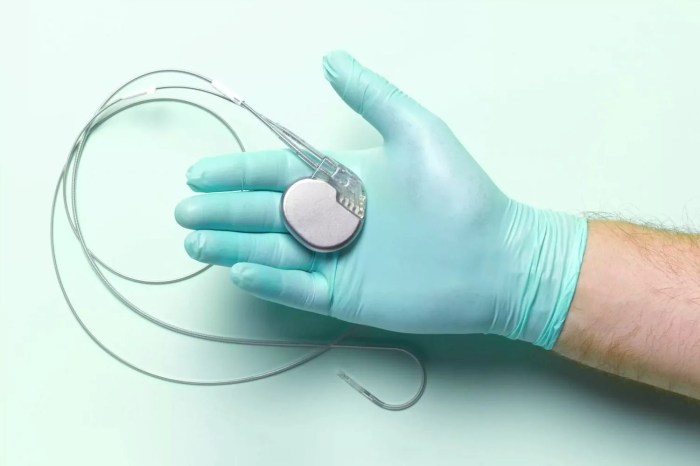 Artificial cardiac pacemaker, 3D rendering - Dr David Begley ... Hawa you daliwonga mp3 download