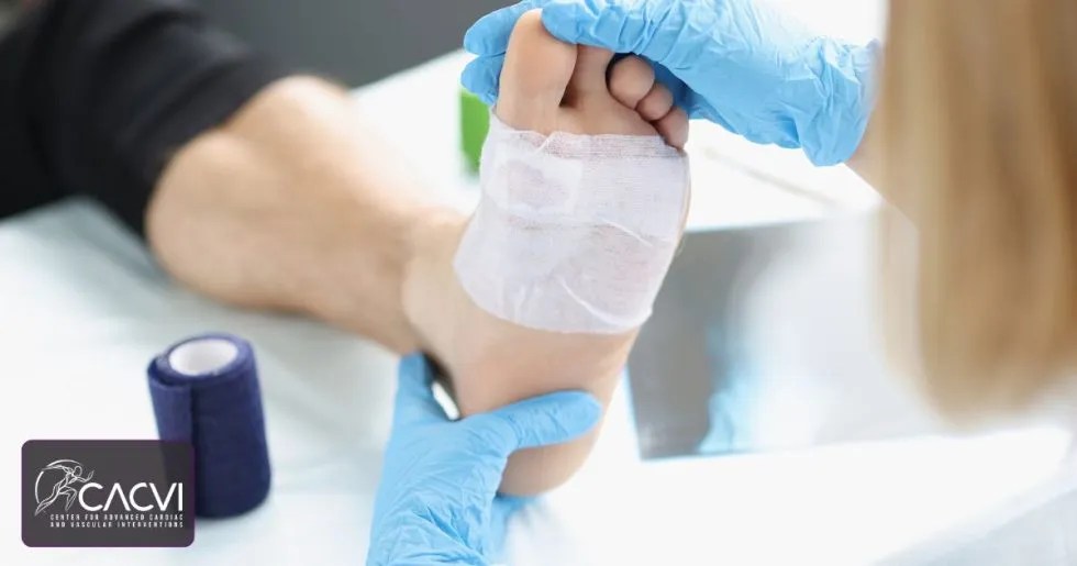 When to See a Doctor for a NonHealing Leg Wound (2025)