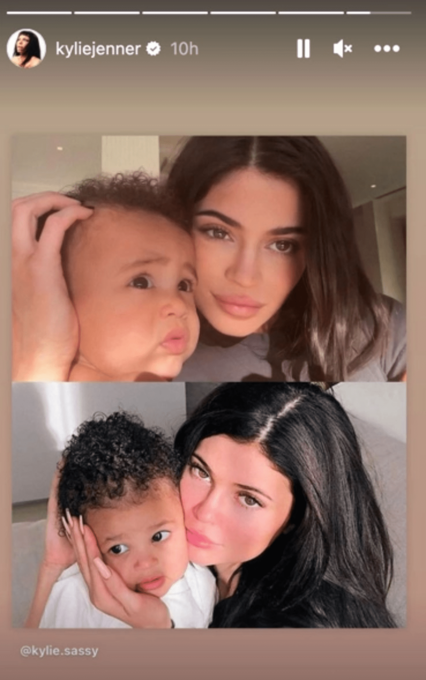 Kylie Jenner Posts SidebySide Photos Comparing Her Daughter Stormi