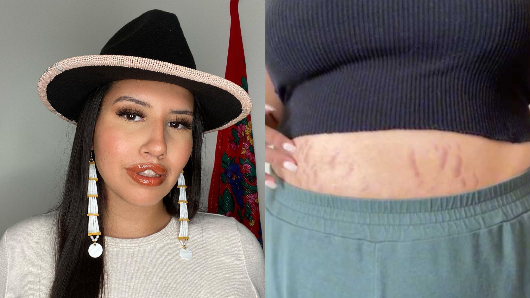Indigenous Mom Posts Inspiring TikTok Celebrating Her Stretch Marks