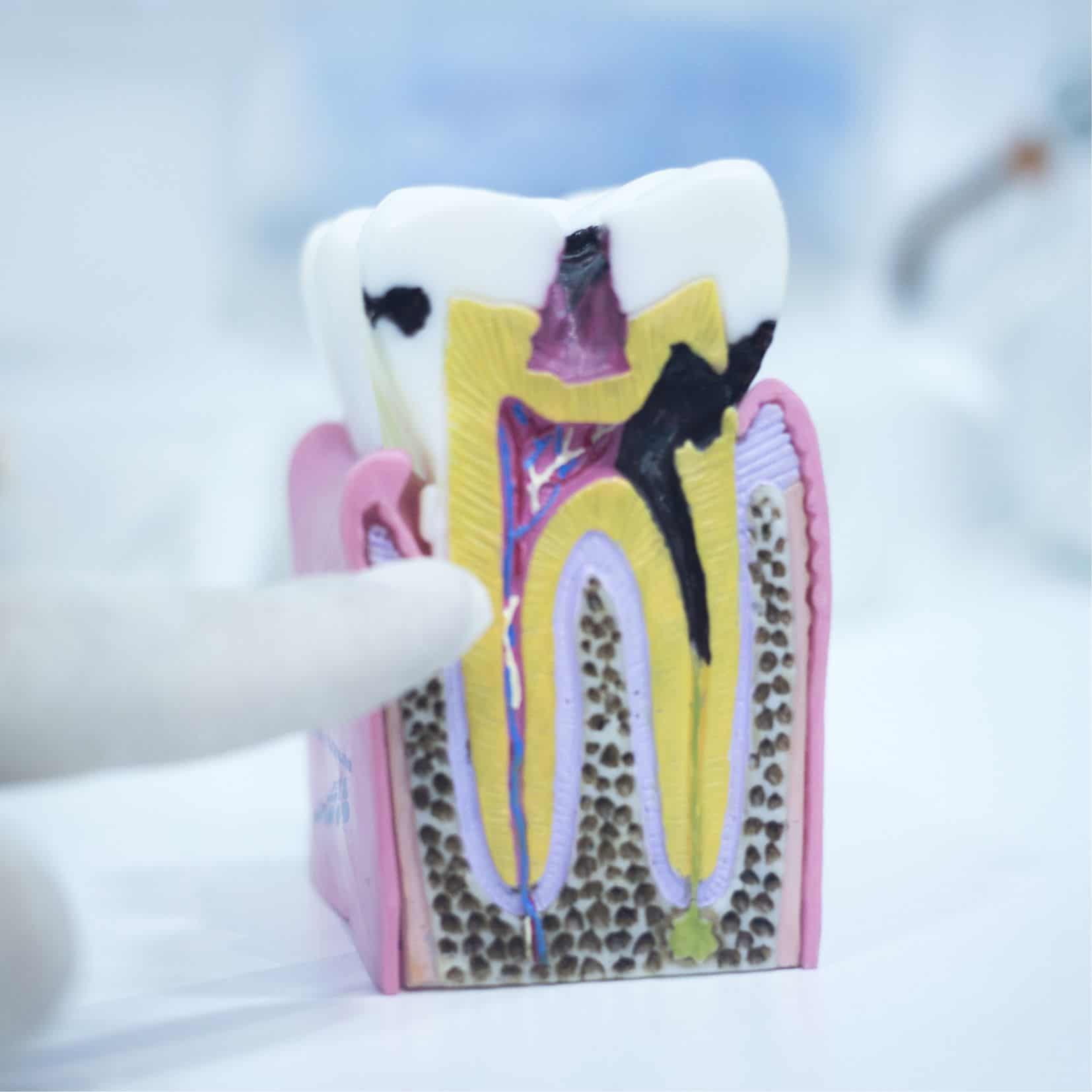 Is iced coffee bad for your teeth 7 Facts