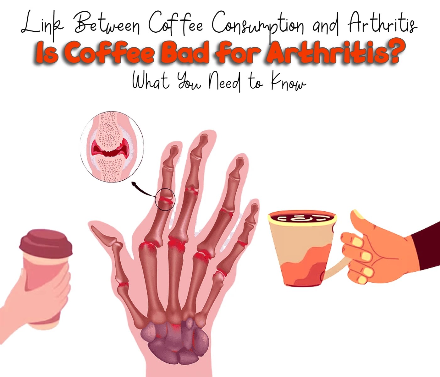 Is Coffee Bad for Arthritis? What You Need to Know