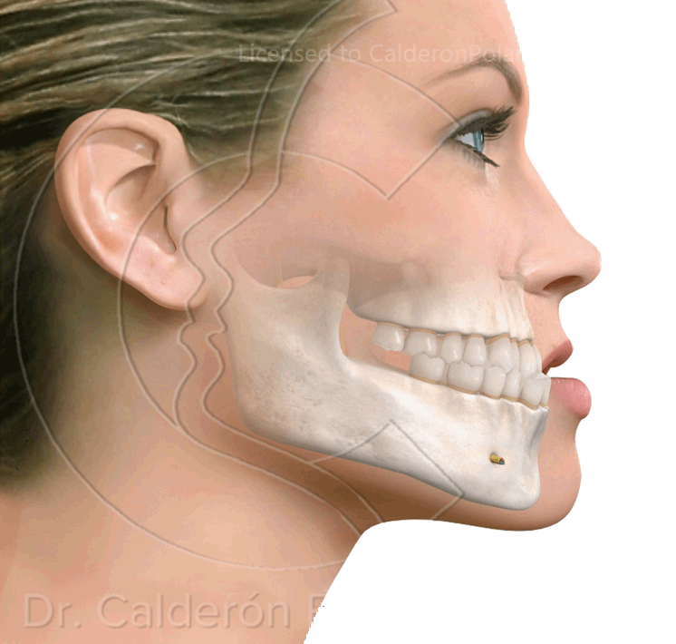 Dr. Javier Calderón Polanco » Cirugía Ortognática