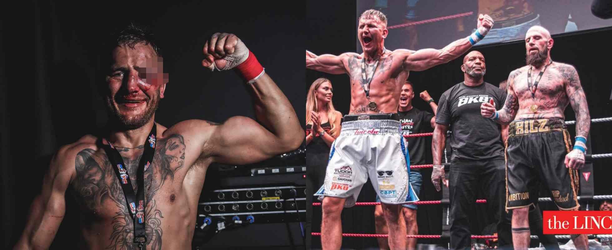 Bareknuckle boxer looks unrecognizable after gruesome eye injury