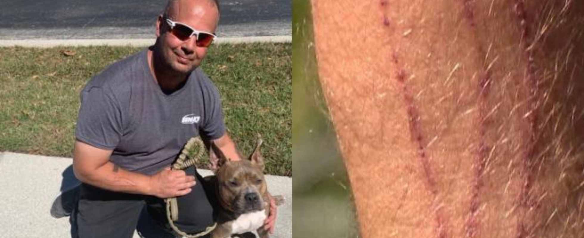 Heroic Florida father fights off bobcat to protect his daughter's dog