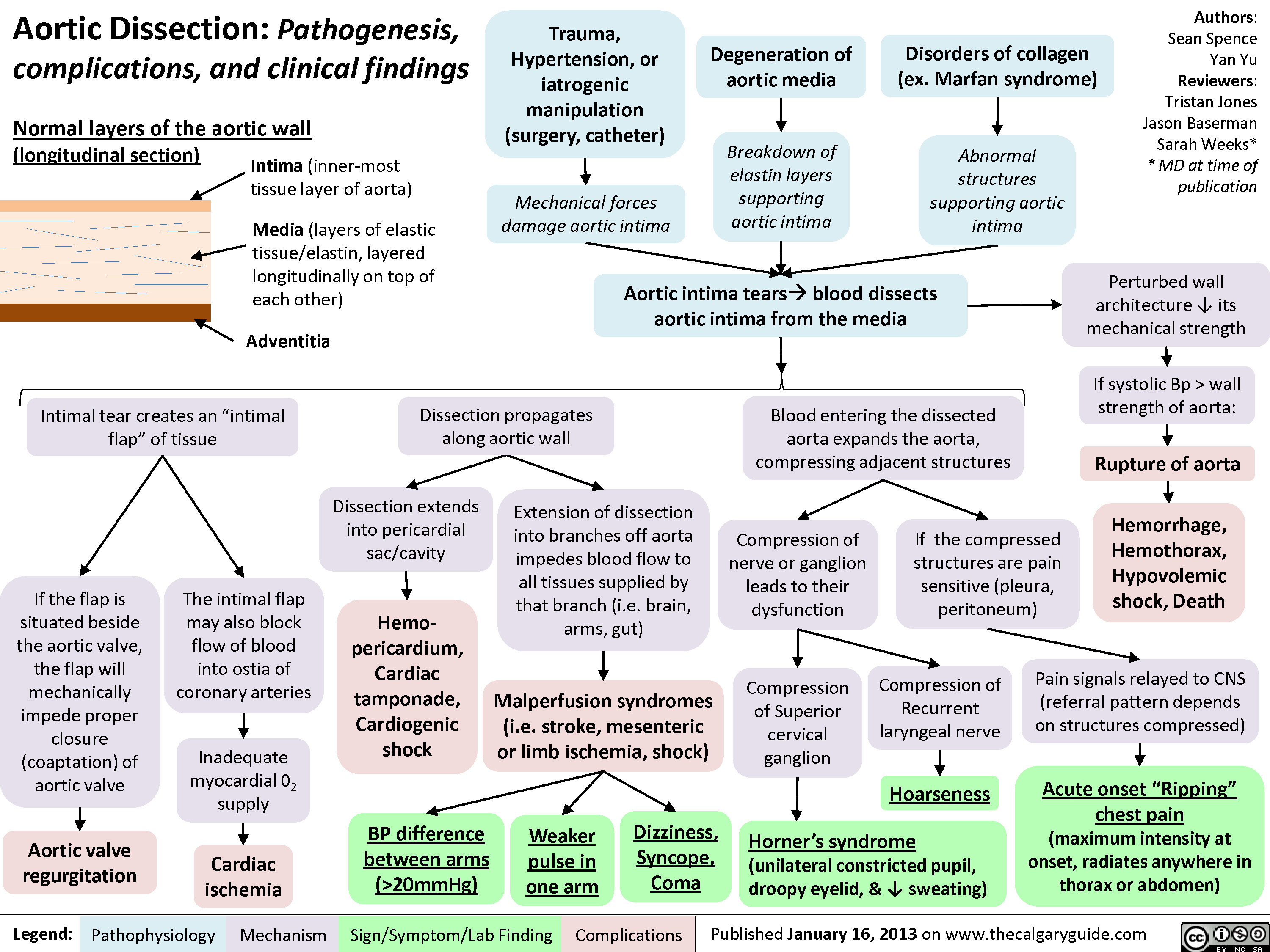 Aortic Dissection Concept Map Aortic Dissection Calgary Guide
