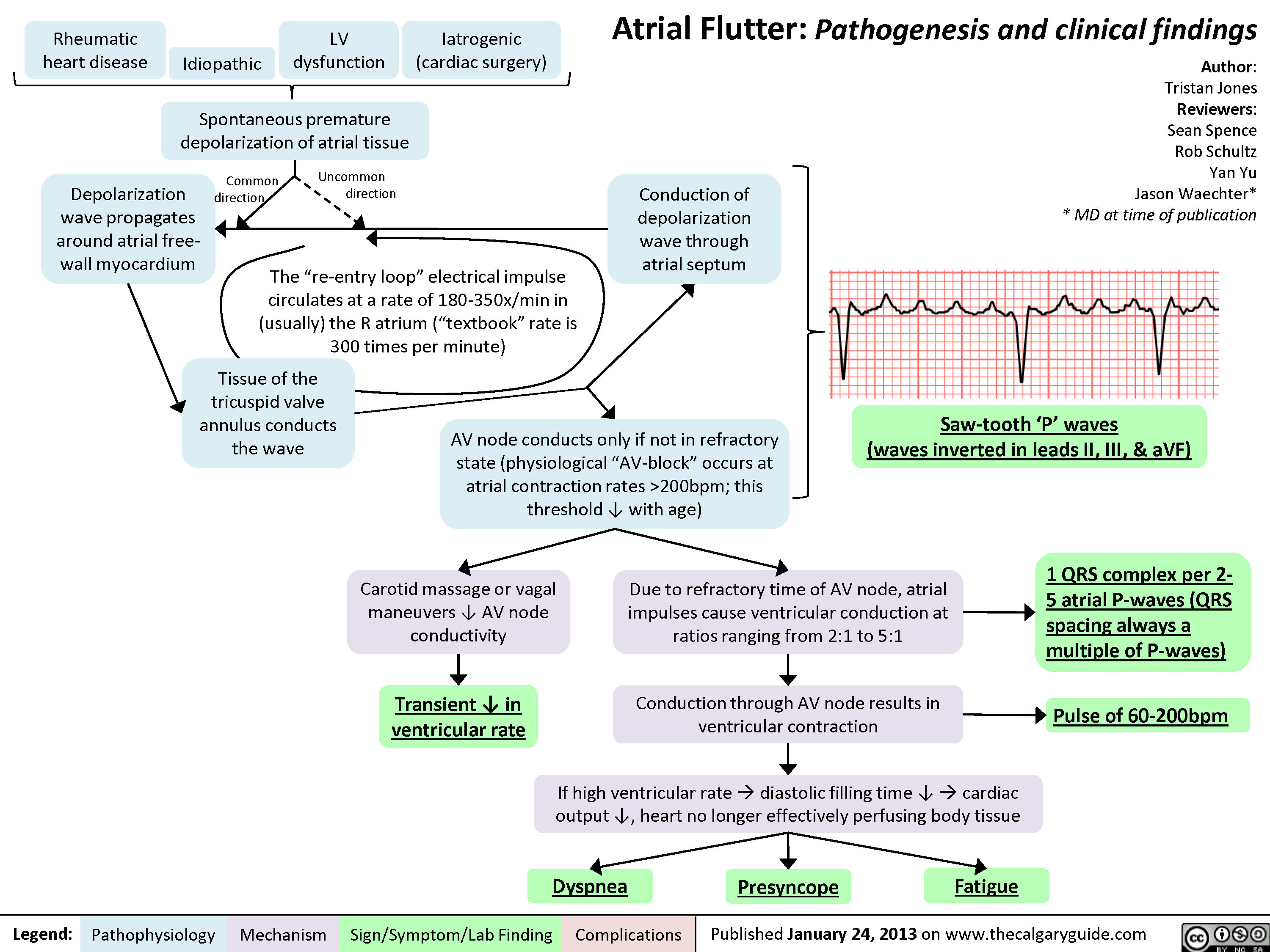 Atrial Flutter (1) Calgary Guide