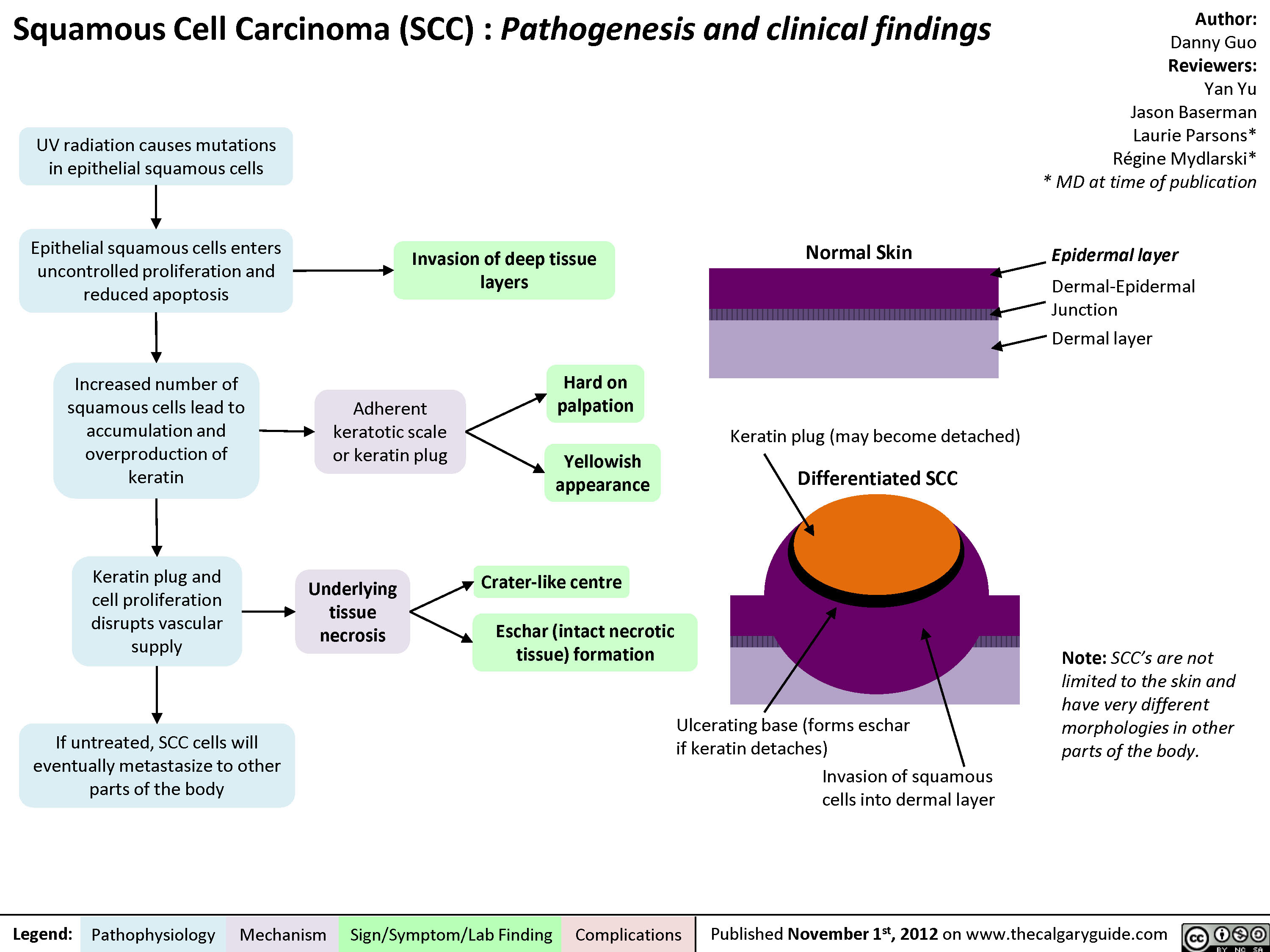 Squamous Cell Carcinoma Diagram