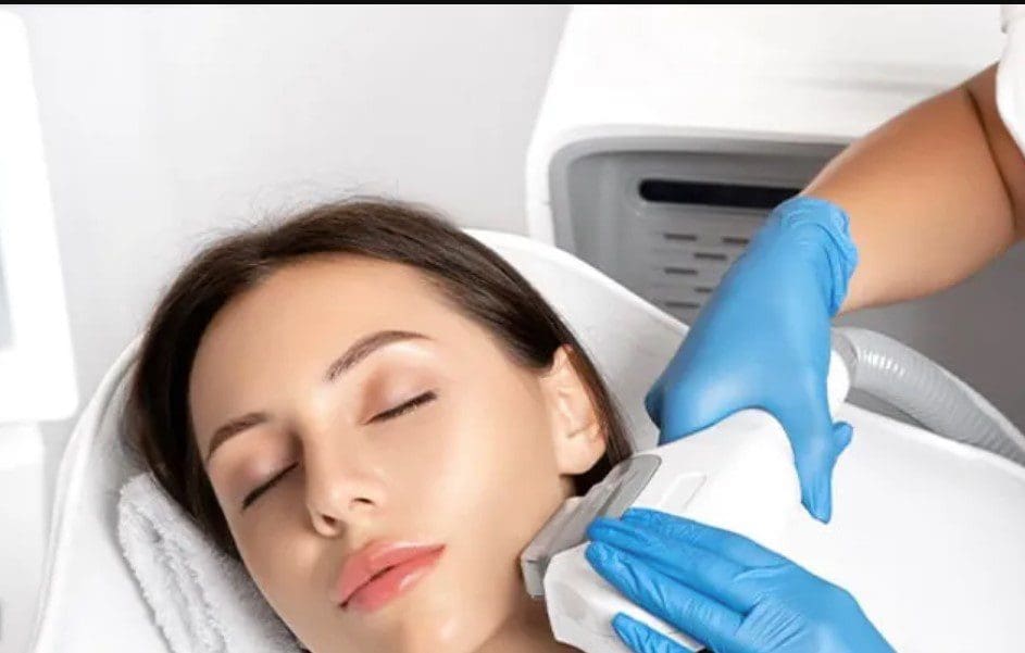 IPL Photofacial Calgary MediSpa