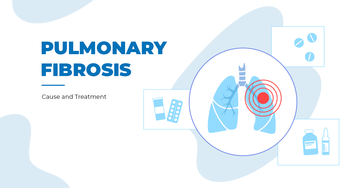 Pulmonary Fibrosis Cause And Treatment California Pulmonary Associates