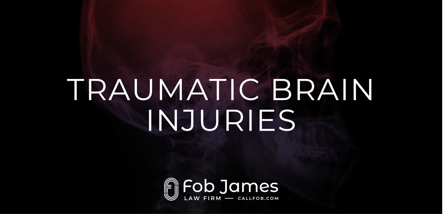 Birmingham Brain Injury Lawyer Fob James Law Firm
