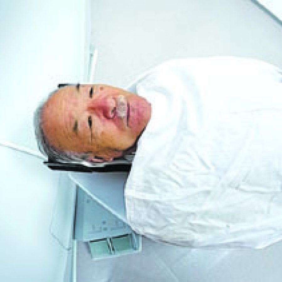 CT scans look to detect lung cancer early St. Louis Call