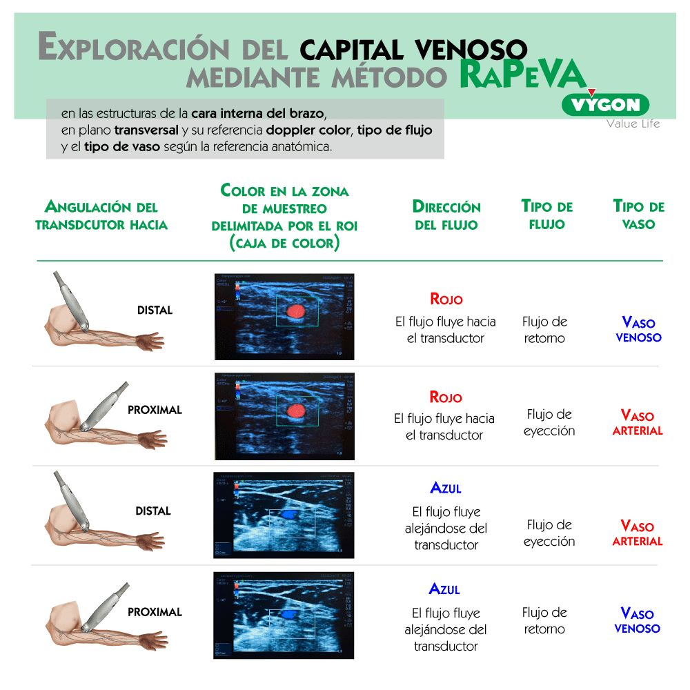 Ecografía doppler principios y aplicaciones básicas para el acceso