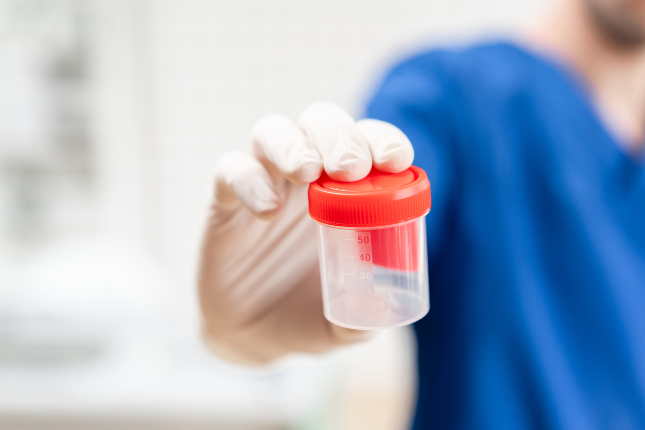Pros and Cons of Drug Testing Your Applicants Canal HR