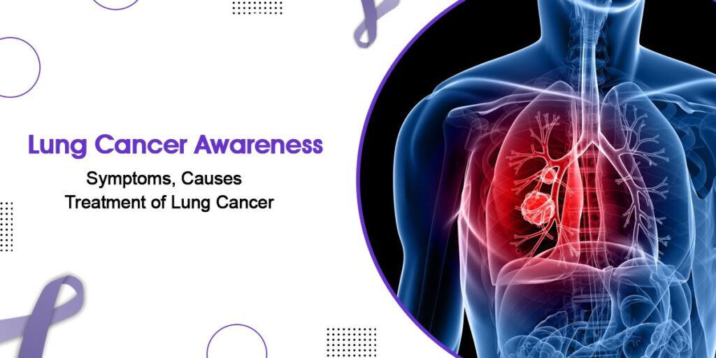 Main Symptoms, Causes, and Treatment of Lung Cancer canceronco