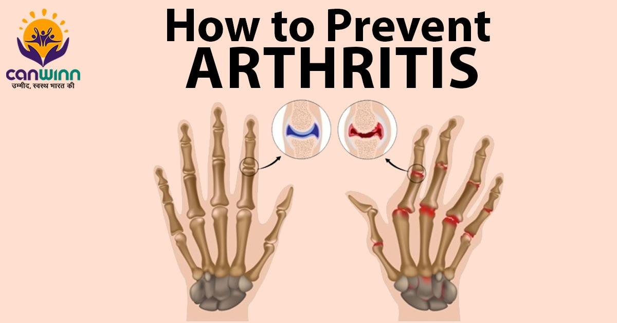 How to Prevent Arthritis 10 Easy Ways Follow Daily Routine Tips