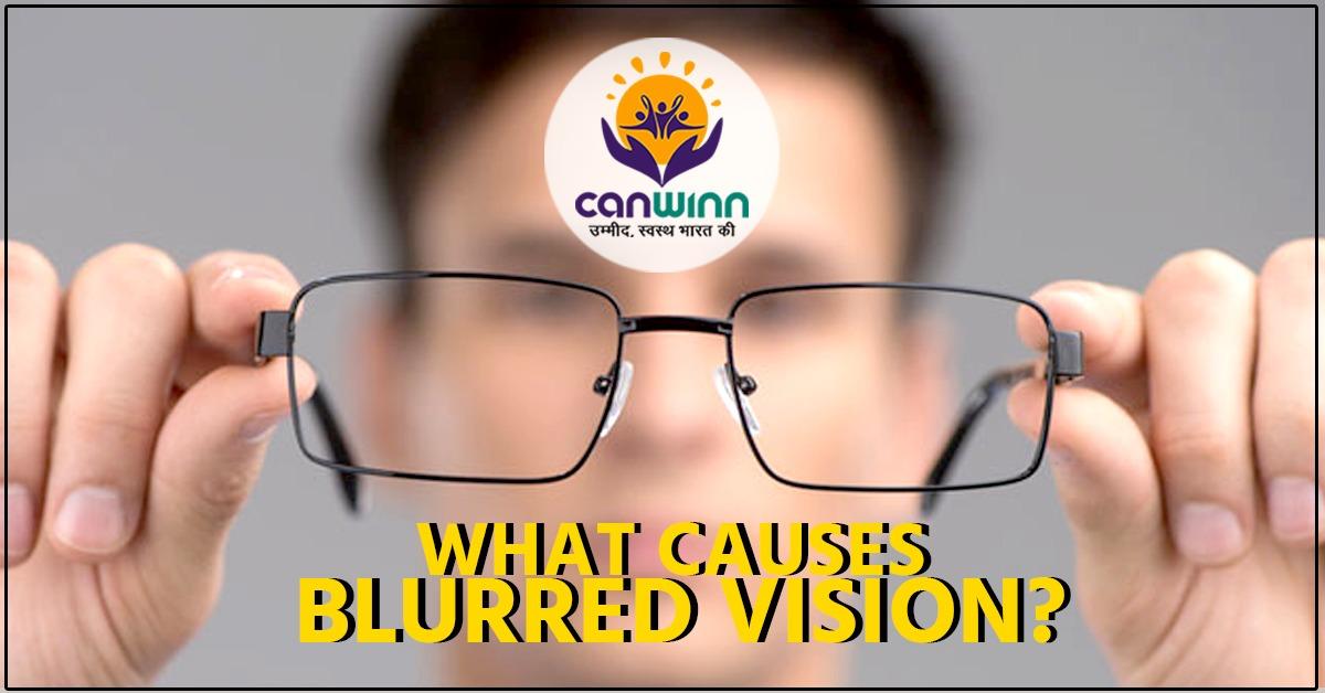 What causes blurred vision? Canwinn