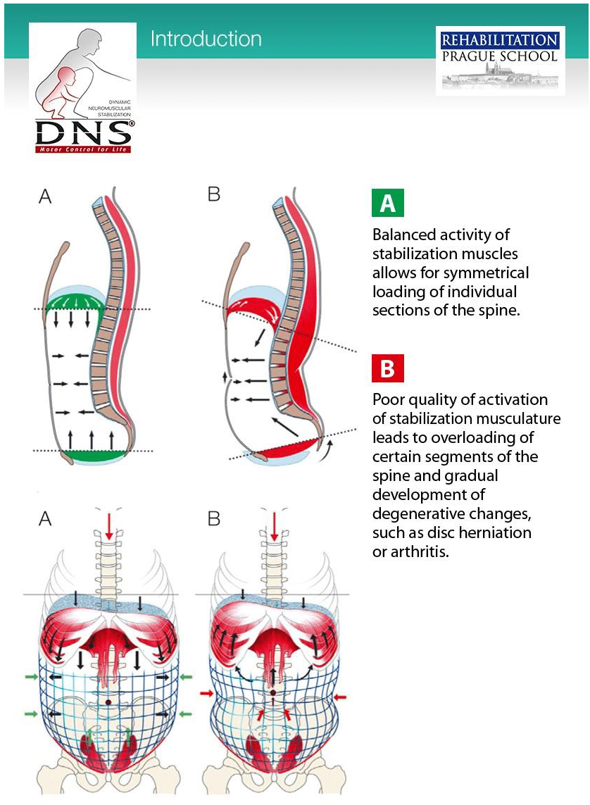 dynamic neuromuscular stabilization Archives Capital Chiropractic