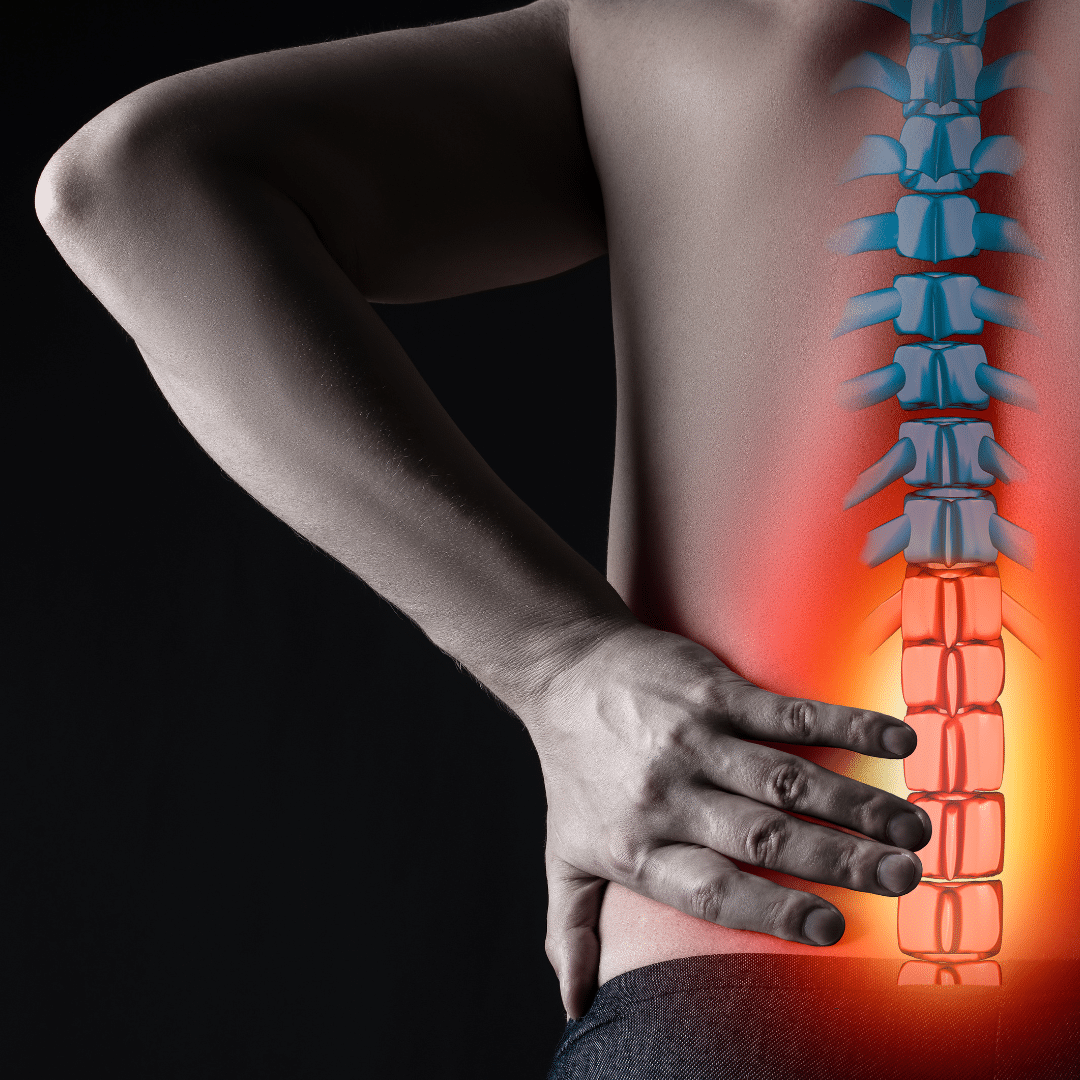 What Could Be Causing Your Sciatica? Capital Chiropractic