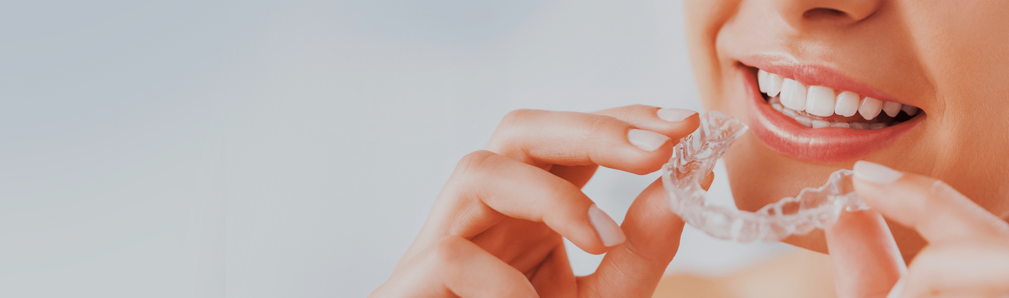 Aligner startups stirring the German dental market Capitalmind Investec