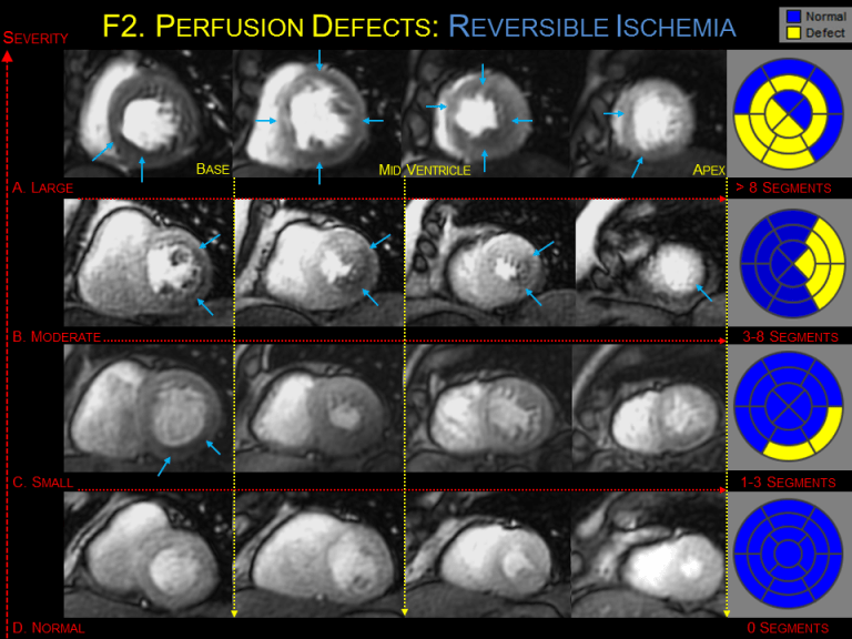 Slide2 Cardiac MRI