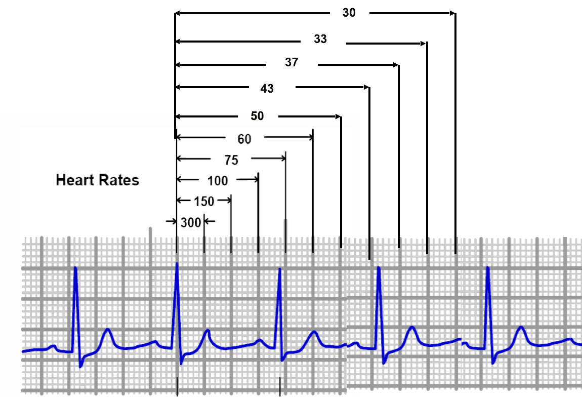 calipermethod Cardiac Sciences Manitoba