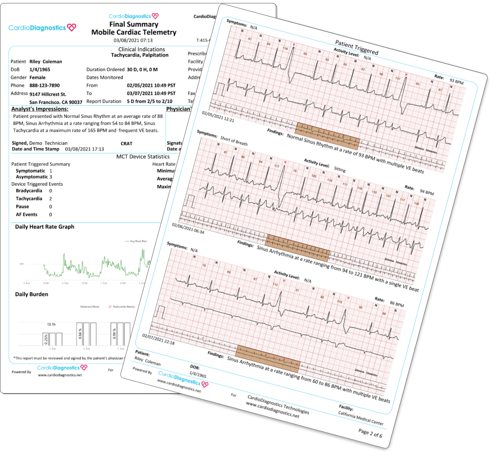 CardioDiagnostics Monitoring Services