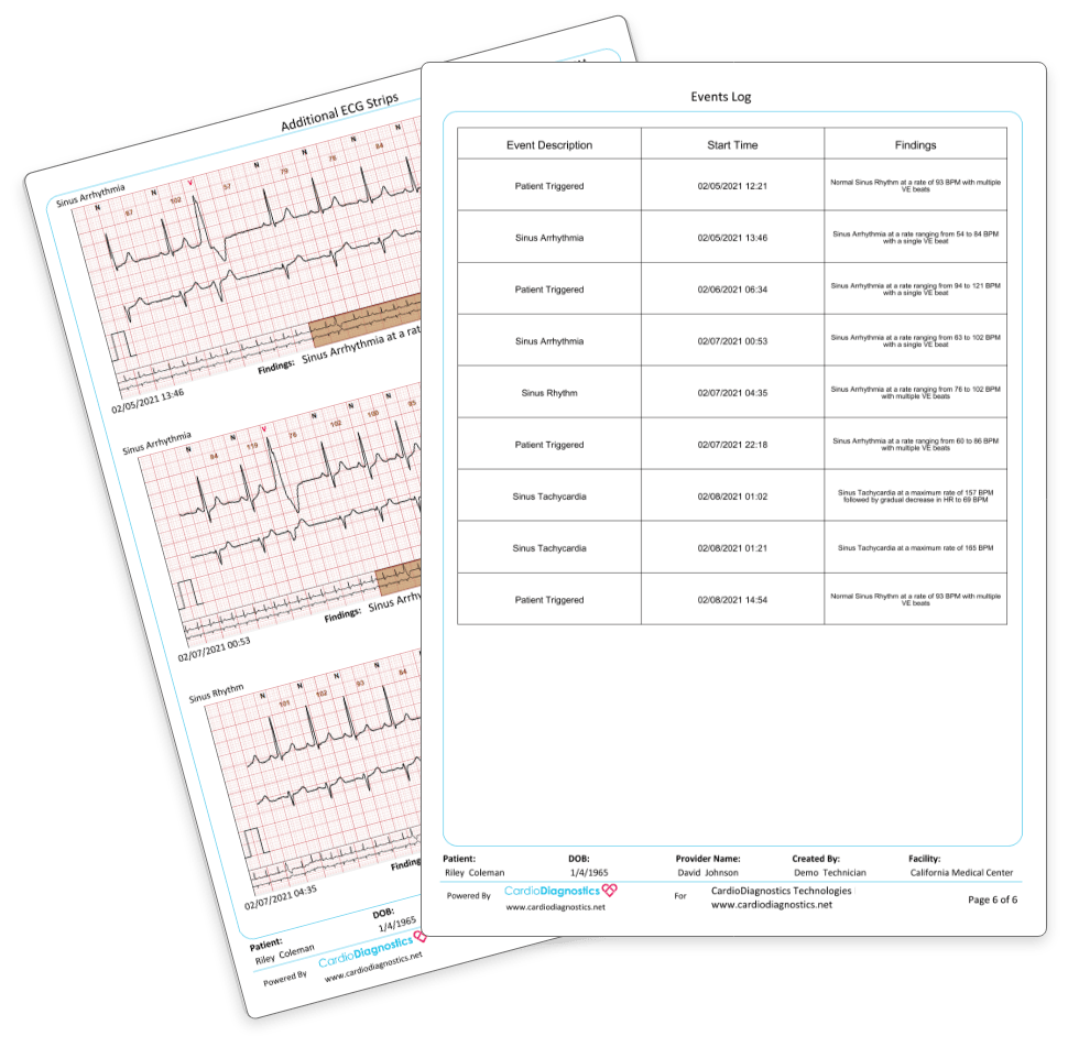 CardioDiagnostics Monitoring Services