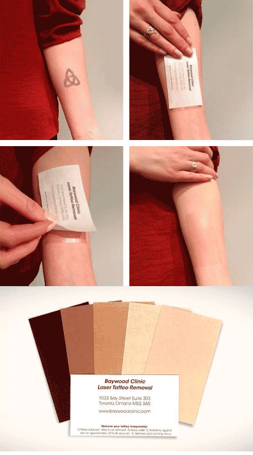 Tattoo Removal Business Card CardObserver