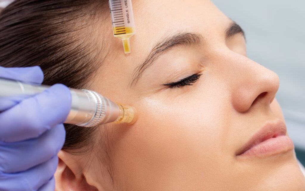 PRP Archives CARE Esthetics