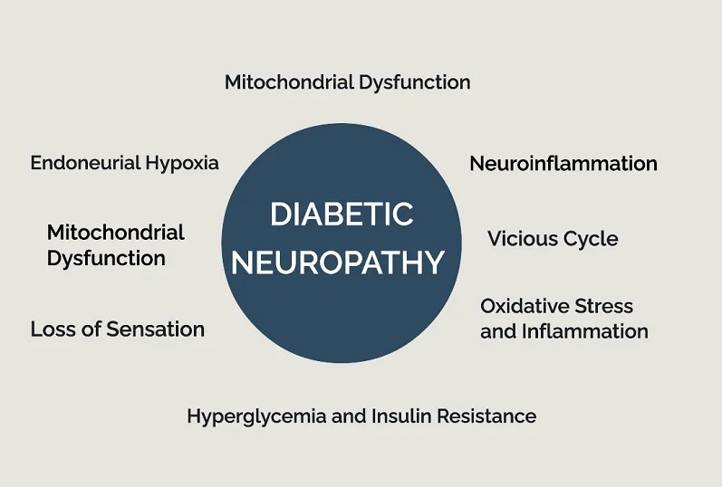 Diabetic Neuropathy ICD10 Understanding Coding & Management Care4Sugar