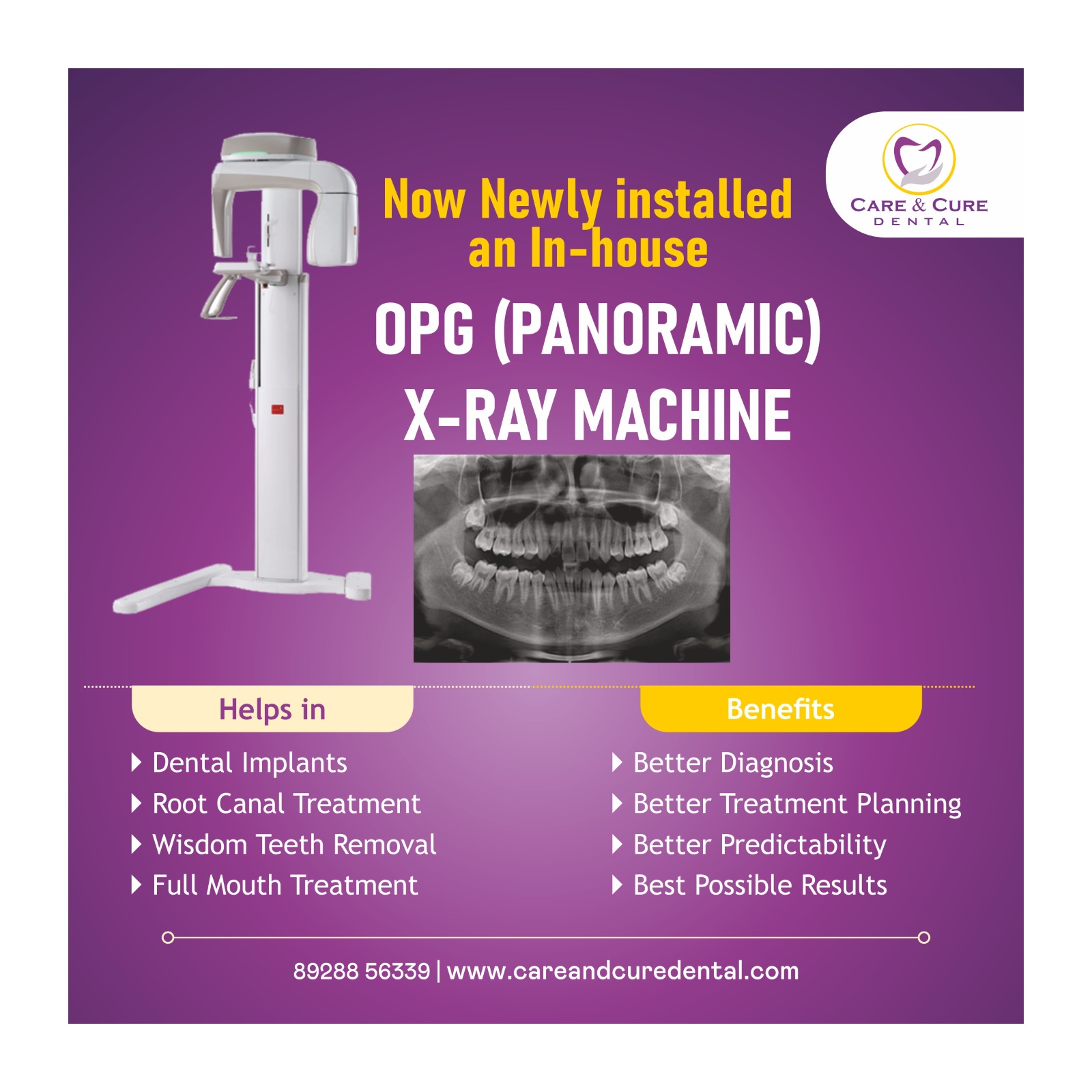 OPG Xray facility dental clinic in dombivli east, mumbai