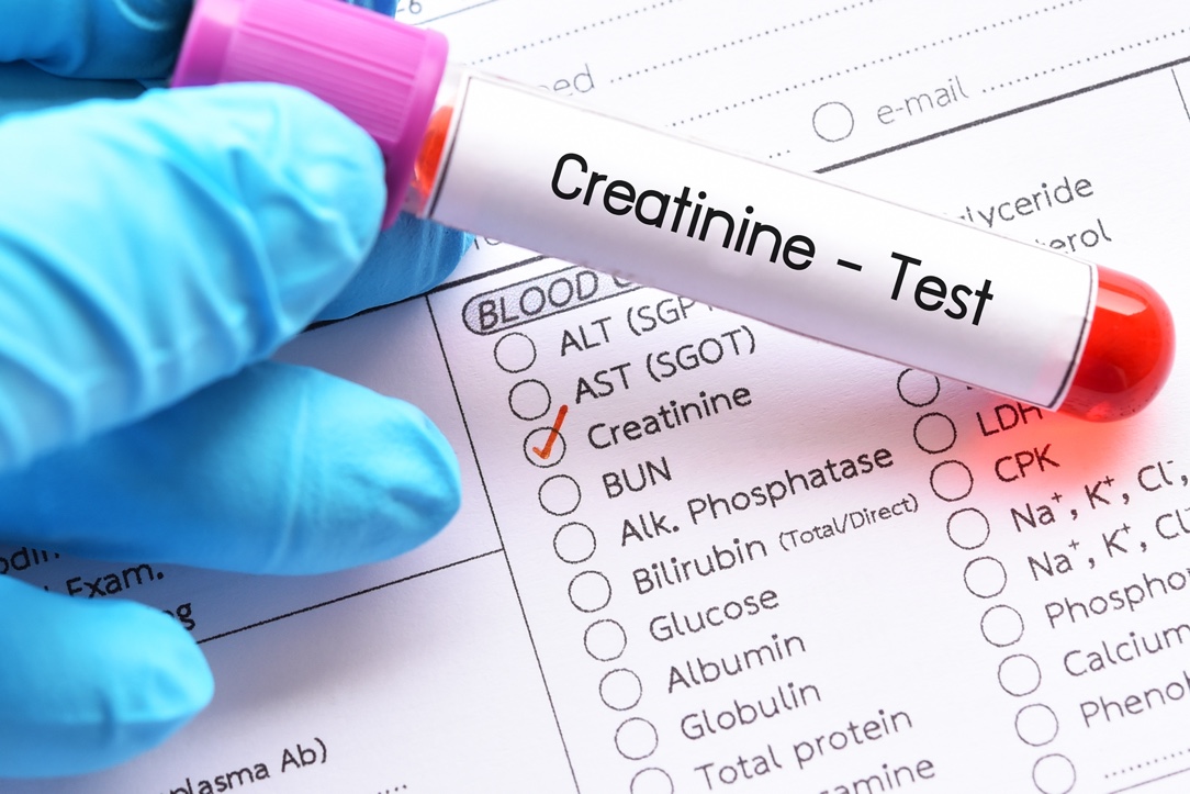 Limitations of Relying on Creatinine After Kidney Transplant CareDx
